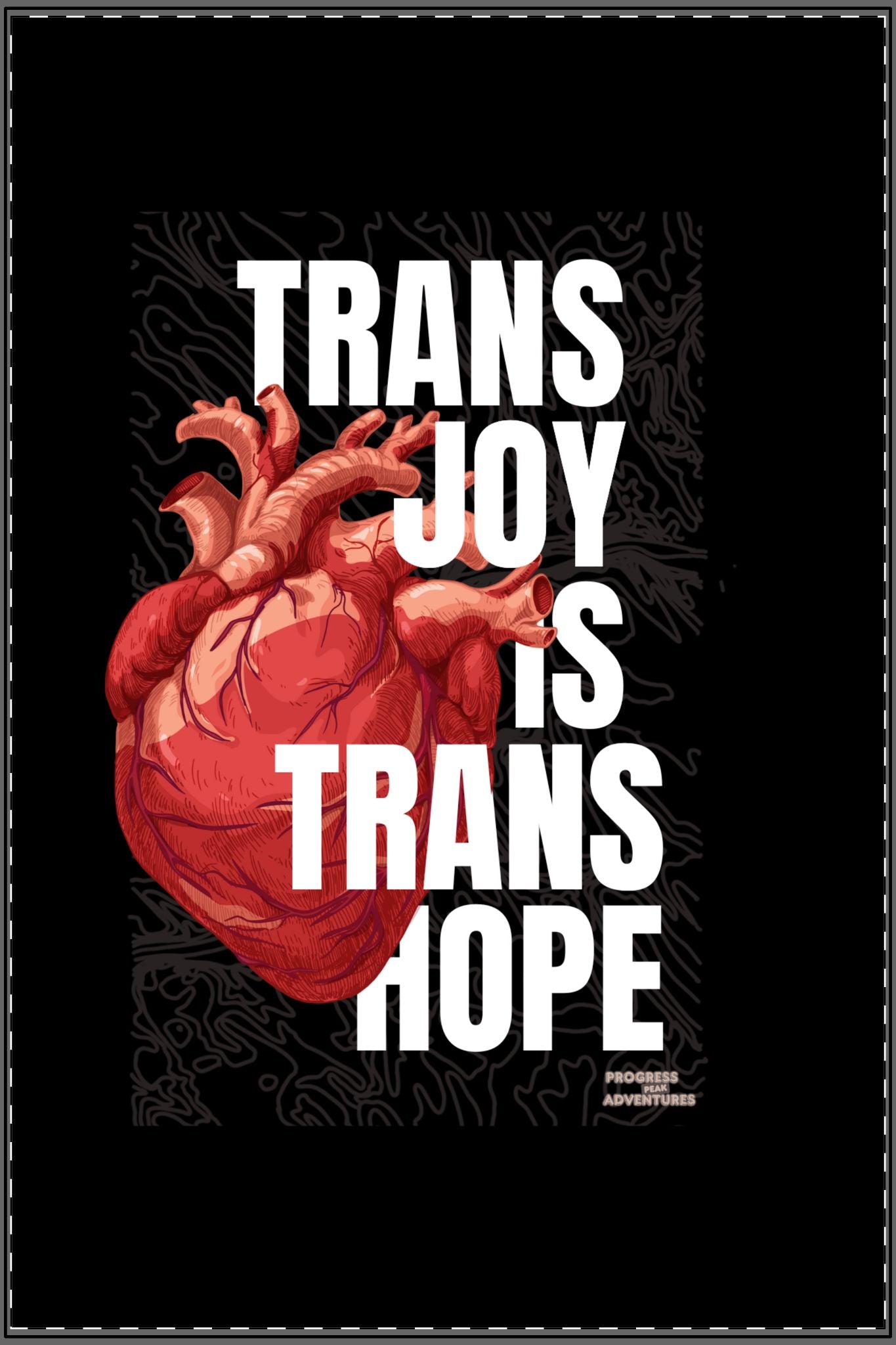 Trans Joy x Trans Hope | Art Print